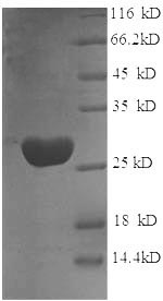 Greater than 90% as determined by SDS-PAGE.Recombinant Rat Glutathione S-Transferase P (GSTP1) Protein (His)