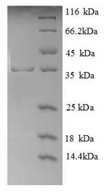 Greater than 90% as determined by SDS-PAGE.Recombinant Human Glycophorin (GYPA) Protein (GST)