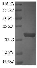 Greater than 90% as determined by SDS-PAGE.Recombinant Human Granzyme B (GZMB) Protein (His)