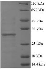 Greater than 90% as determined by SDS-PAGE.