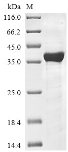 Greater than 85% as determined by SDS-PAGE.Recombinant Human Hyaluronan And Proteoglycan Link Protein 2 (HAPLN2) Protein (His)