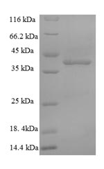 Greater than 90% as determined by SDS-PAGE.Recombinant Mouse Hyaluronan Synthase 2 (HAS2) Protein (His)