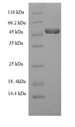 Greater than 90% as determined by SDS-PAGE.Recombinant Mouse Hyaluronan Synthase 2 (HAS2) Protein (His-SUMO)