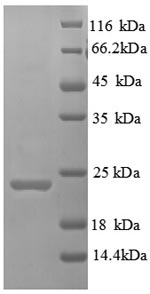 Greater than 90% as determined by SDS-PAGE.Recombinant Human Hepatitis A Virus Cellular Receptor 2 (HAVCR2) Protein (His)