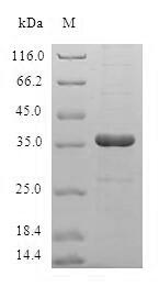 Greater than 90% as determined by SDS-PAGE.Recombinant Human Hepatitis B Virus X-Interacting Protein (LAMTOR5) Protein (GST)