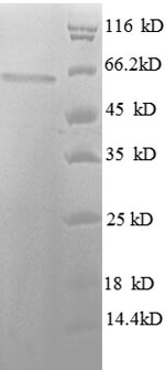 Greater than 90% as determined by SDS-PAGE.Recombinant Human Histone Deacetylase 3 (HDAC3) Protein (His-SUMO)