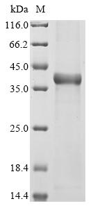 Greater than 90% as determined by SDS-PAGE.Recombinant Human Histone Deacetylase 6 (HDAC6) Protein (His)