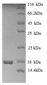 Greater than 90% as determined by SDS-PAGE.Recombinant Human Histone H2A Type 1 (HIST1H2AG) Protein (His)