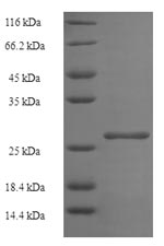Greater than 90% as determined by SDS-PAGE.Recombinant Human Histone H2B Type 1-B (HIST1H2BB) Protein (His-SUMO)