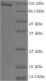 Greater than 90% as determined by SDS-PAGE.Recombinant Human Holliday Junction Recognition Protein (HJURP) Protein (His-SUMO)