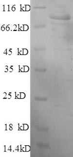 Greater than 90% as determined by SDS-PAGE.Recombinant Human Hexokinase-1 (HK1) Protein (His)