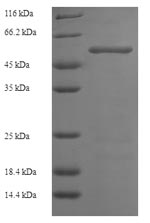 Greater than 90% as determined by SDS-PAGE.Recombinant Human Hexokinase-1 (HK1) Protein (His)