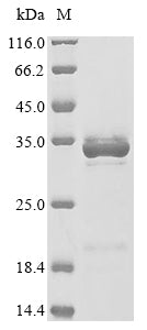Greater than 85% as determined by SDS-PAGE.Recombinant Rat High Mobility Group Protein B1 (HMGB1) Protein (His)
