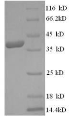 Greater than 90% as determined by SDS-PAGE.Recombinant Human 3-Hydroxy-3-Methylglutaryl-Coenzyme A Reductase (HMGCR) Protein (His)