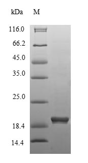 Greater than 85% as determined by SDS-PAGE.Recombinant Mouse 3-Hydroxy-3-Methylglutaryl-Coenzyme A Reductase (HMGCR) Protein (His)