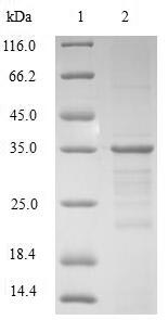 Greater than 90% as determined by SDS-PAGE.Recombinant Human Non-Histone Chromosomal Protein Hmg-17 (HMGN2) Protein (GST)