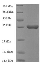 Greater than 90% as determined by SDS-PAGE.Recombinant Human Heme Oxygenase 1 (HMOX1) Protein (His)