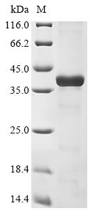Greater than 85% as determined by SDS-PAGE.Recombinant Mouse Histamine N-Methyltransferase (HNMT) Protein (His&Myc)