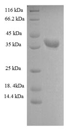 Greater than 90% as determined by SDS-PAGE.Recombinant Human Heterogeneous Nuclear Ribonucleoprotein A1 (HNRNPA1) Protein (His)
