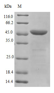 Greater than 90% as determined by SDS-PAGE.Recombinant Human Heterogeneous Nuclear Ribonucleoproteins A2/B1 (HNRNPA2B1) Protein (His-B2M)