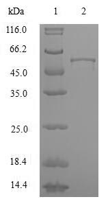 Greater than 90% as determined by SDS-PAGE.Recombinant Human Heterogeneous Nuclear Ribonucleoproteins A2/B1 (HNRNPA2B1) Protein (GST)