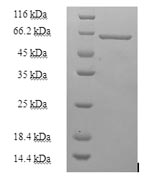 Greater than 90% as determined by SDS-PAGE.Recombinant Human Heterogeneous Nuclear Ribonucleoprotein H (HNRNPH1) Protein (His-SUMO)