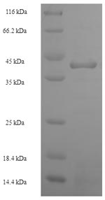 Greater than 90% as determined by SDS-PAGE.Recombinant Human Heterogeneous Nuclear Ribonucleoprotein L (HNRNPL) Protein (His-SUMO)