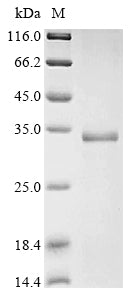 Greater than 90% as determined by SDS-PAGE.