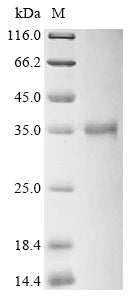 Greater than 90% as determined by SDS-PAGE.