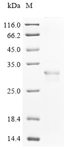 Greater than 85% as determined by SDS-PAGE.