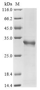 Greater than 85% as determined by SDS-PAGE.