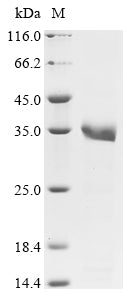 Greater than 85% as determined by SDS-PAGE.