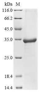 Greater than 85% as determined by SDS-PAGE.