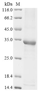 Greater than 85% as determined by SDS-PAGE.