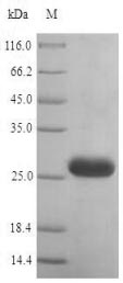 Greater than 90% as determined by SDS-PAGE.Recombinant Human Histamine H1 Receptor (HRH1) Protein (His)