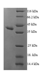Greater than 90% as determined by SDS-PAGE.