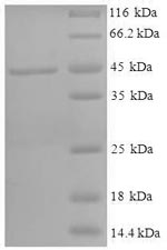 Greater than 90% as determined by SDS-PAGE.Recombinant Human 11-Beta-Hydroxysteroid Dehydrogenase 1 (HSD11B1) Protein (His-SUMO)
