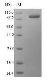 Greater than 90% as determined by SDS-PAGE.Recombinant Human Heat Shock Protein Hsp 90-Beta (HSP90AB1) Protein (His&Myc)