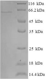 Greater than 90% as determined by SDS-PAGE.Recombinant Human Indoleamine 2,3-Dioxygenase 2 (IDO2) Protein (His-SUMO)