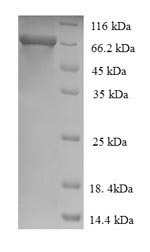 Greater than 90% as determined by SDS-PAGE.Recombinant Human Alpha-L-Iduronidase (IDUA) Protein (His)