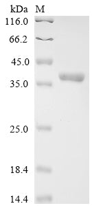 Greater than 90% as determined by SDS-PAGE.Recombinant Human Interferon-Induced 35 Kda Protein (IFI35) Protein (His)