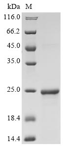 Greater than 90% as determined by SDS-PAGE.