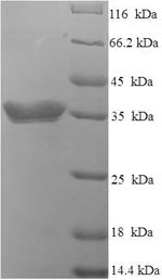 Greater than 90% as determined by SDS-PAGE.Recombinant Human Interferon Alpha-4 (IFNA4) Protein (His-SUMO)