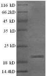 Greater than 90% as determined by SDS-PAGE.Recombinant Sheep Interferon Gamma (IFNG) Protein (His)