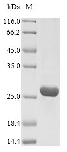 Greater than 90% as determined by SDS-PAGE.Recombinant Human Insulin-Like Growth Factor 1 Receptor (IGF1R) Protein (His)