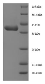 Greater than 90% as determined by SDS-PAGE.Recombinant Mouse Insulin-Like Growth Factor-Binding Protein 1 (IGFBP1) Protein (His-SUMO)