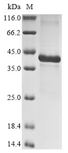 Greater than 85% as determined by SDS-PAGE.Recombinant Human Insulin-Like Growth Factor-Binding Protein 5 (IGFBP5) Protein (His&Myc)