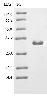 Greater than 90% as determined by SDS-PAGE.Recombinant Mouse Immunoglobulin J Chain (JCHAIN) Protein (His-SUMO)