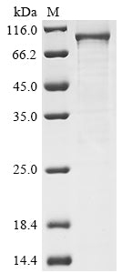 Greater than 85% as determined by SDS-PAGE.Recombinant Human Inhibitor Of Nuclear Factor Kappa-B Kinase Subunit Beta (IKBKB) Protein (His)