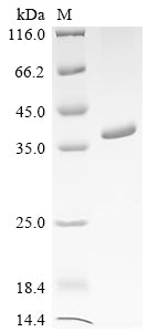 Recombinant Human Interleukin-12 Subunit Beta (IL12B) Protein (His ...